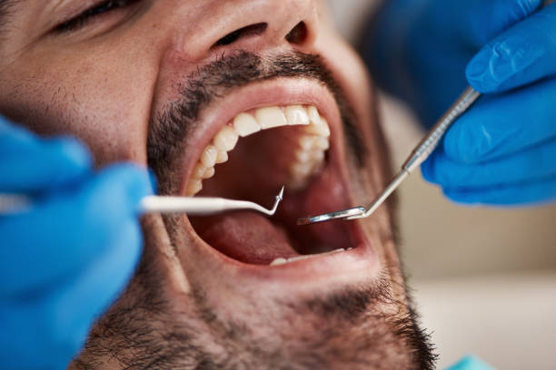 Best Orthodontic Emergency Dentist in Osgood, IN